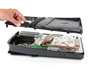 Right‑Side Inner Shell Removal